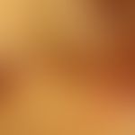 psoriasis intertriginosa: 65-year-old patients. sharply defined, red, in places slightly weeping,...