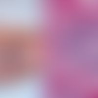 Aromatase-Hemmstoffe: schwere leukozytoklastische Vaskulitis unter der Therapie mit einem Aromata...