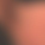 LEKTI: Netherton-Syndrom: ichthyosiforme Erythrodermie mit korneolytischer Schuppung.
