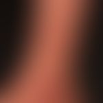 Artefakte: punkt- und strichförmige Erosionen&nbsp;und Krustenbildungen. Am Handrücken großflächi...