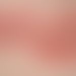 Pemphigoid, bullöses:&nbsp;prall gespannte, mit klarem Sekret gefüllte Blasen auf flächigbem Eryt...
