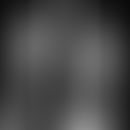 Periostales Chondrom (entommen aus eref.thieme)
