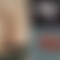 Ependymom extraspinales:&nbsp;klinischer, sonographischer und anatomischer Befund. Entnommen aus:...