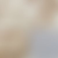 Immunhistochemie. A: Tumorzellen exprimieren HMB-45; B: Tumorzellen sind immunphänotypisch positi...