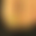 Onychogrypose: Mann, 57 Jahre. Rechter Fuß keine Auffälligkeiten. Nur li 1. und 2. Zehe, gering a...