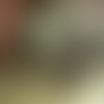 Melanom akrolentiginöses, Auflichtmikroskopie: schwarz gefärbte Leistenhaut der Kleinzehe bei 75 ...