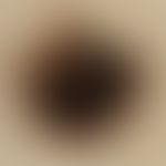 Naevus melanozytärer dysplastischer, Auflichtmikroskopie, histologisch gesichert.
