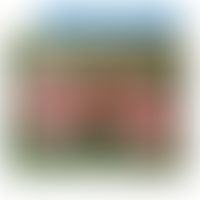 Streptococcus viridans: Rasterelektronenmikroskopische Aufnahme&nbsp;

