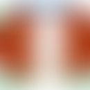 Zystische Nephropathien:&nbsp;Schematische Darstellung einer Zystenniere. Vorlage: Klinikum Dortm...