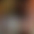 Ulcus molle:&nbsp;A, B: genitales Befallsmuster. Ghana (David Mabey). C, D:&nbsp;extragenitale Ul...