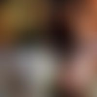 Ulcus molle:&nbsp;A, B: genitales Befallsmuster. Ghana (David Mabey). C, D:&nbsp;extragenitale Ul...