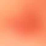 Differenzildiganose: Basalzellkarzinom pigmentiertes

Diagnose:&nbsp; gering pigmentiertes Melano...