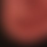 Dermatomyositis: raue rissige Fingerkuppen. Hyperkeratotischer Nagelfalz des Daumens.&nbsp;
