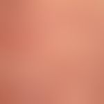 Erythema anulare centrifugum: multiple, chronisch aktive, zentrifugal wachsende, rote, randständi...