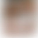 KRT9-Gen: Diffuse Palmoplantarkeratosen mit Nachweis der KRT9-Mutation. Enommen aus&nbsp;Li Y et ...