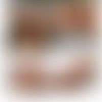 KRT9-Gen: Diffuse Palmoplantarkeratosen mit Nachweis der KRT9-Mutation. Enommen aus&nbsp;Li Y et ...