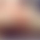 Donovanosis: weiches gelblich schmierig bedecktes&nbsp;nicht schmerzhaftes Ulkus. Entnommen aus: ...
