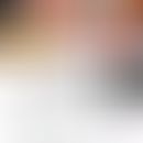 Odonto-onycho-dermale Dysplasie: Zusammenstellung der Symptome. Abb. entnommen aus&nbsp;Nawaz S e...