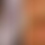 Keratosis linearis mit Ichthyosis congenita und sklerosierendem Keratoderm mit Mutationen in POMP...