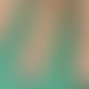 Adermatoglyphie, isolierte kongenitale: komplett fehlende Leistenstrutkur der Finger. Abb. entomm...