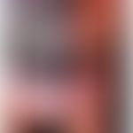 Palmoplantarkeratose aquagene mit Mutation in CFTR: nach kurzem Wasserkontakt aufquellende Handfl...
