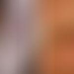 Keratosis linearis mit Ichthyosis congenita und sklerosierendem Keratoderm (KLICK-Syndrom): trans...