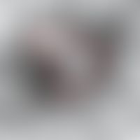 Perforierende reaktive Kollagenose, Elektronenmikroskopie: Zwischen den Keratinozyten (K) eingesc...