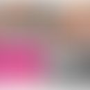 Epidermolytische Ichthyose: Bräunliche Hyperkeratose am Gesäß und in den infraglutealen Falten mi...