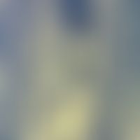 Erweiterte Kapillarschlinge im Papillarkörper, gefüllt mit Erythrozyten, Semidünnschnitt.
