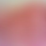 Dyskeratosis follicularis. Akantholytische Zellen intraepidermal mit Spaltbildung
