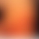 Dyskeratosis follicularis. postnatal aufgetretene rötliche, erhabene, zu Plaques konfluierende Pa...