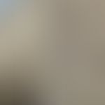 Porokeratosis linearis unilateralis: Lineare Anordnung keratotischer Papeln. Abb. entommen aus:&n...