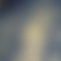 Papillarkörper mit enthaltener Kapillare und entzündlichem Infiltrat; Semidünnschnitt; s.a. nächs...