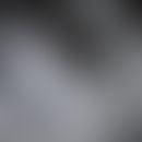 Basallamina: Elektronenmikroskopische Aufnahme der Basallamina der Epidermis
