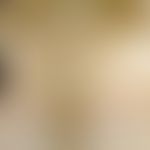 Sklerodermie zirkumskripte: v.a. in den Druckstellen (Gürtelregion, submammär) lokalisierte Herde...
