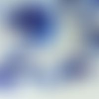 Gonorrhoe. Abstrich aus Urethra, zahlreiche neutrophile Granulozyten intra- und extrazellulär gel...