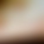 Purpura Schönlein-Henoch: eingeblutete, z.T. dunkel eingetrocknete Bläschen an der Fußsohle, zirz...