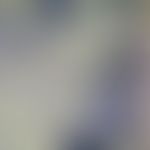 Melanom; Semidünnschnitt subepidermale Melanomzellen
