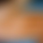 Pustulosis palmaris et plantaris: Multiple gelbliche Pusteln in der Handfläche und auf den Beuges...