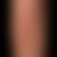 Artefakte: strichförmige Narben. Keinerlei Hinweis auf autochthone dermatologische Erkrankung.&nb...