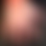 Hand-Fuß-Mund-Krankheit:&nbsp;seit etwa 1 Woche, &nbsp;schmerzhafte, Bläschen, Blasen&nbsp; und P...