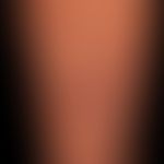 Differenzialdiagnose: Prurigo nodularis

Diagnose: Papulöse Dermatitis in der Schwangerschaft&nbs...