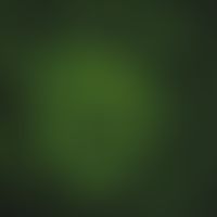 IgA-Nephropathie: immunfluoreszenzmikrosko0ischer Nachweis von IgA-Ablagerungen in den Glomerulum...