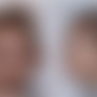 Nijmegen-Breakage-Syndrom:Typische Physiognomie. Abb. entnommen aus:&nbsp;Chrzanowska KH et al. (...