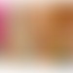 Prurigo chronische vom Typ Prurigo nodularis. Abb. entommen aus:&nbsp;Kwon CD et al. (2019)

