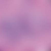 Eosinophile Dermatose bei hämatologischer Neoplasie:&nbsp;perivaskulär und perineural angeordnete...