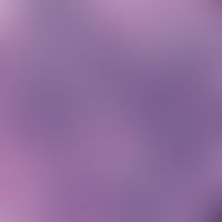 Eosinophile Dermatose bei hämatologischer Neoplasie:&nbsp;dichtes diffuses lymphozytäres Infiltra...