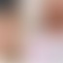 Haarzellleukämie: Spezifische Infiltrate der Haut. Abbildungen entnommen aus: Robak E et al. (202...