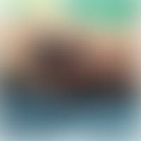 Pyoderma gangraenosum&nbsp;infolge Immundedfizienz bei&nbsp;Haarzellleukämie. Abbildungen entnomm...