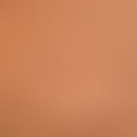 Differenzialdiagnose:&nbsp;Granuloma anulare (disseminierte Variante)

Diagnose:&nbsp;Lichen niti...
